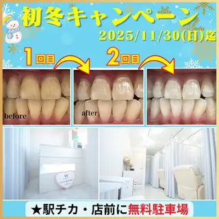 メンズ ホワイトニング ショップくずは店のエステ・リラクイメージ