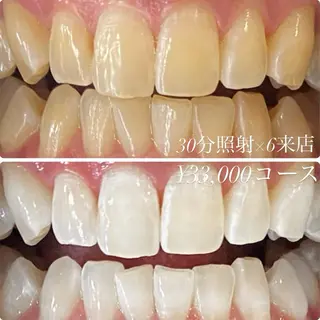 メンズ ホワイトニングルーム 川崎店所属・ホワイトニング ルーム 川崎店のその他イメージ