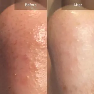 Mandarin Orange所属・毛穴から始める肌メン テマンダリンオレンジのエステ・リラクイメージ