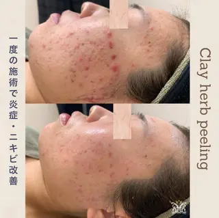 美肌&アロマ🌙 nana 目白/池袋のエステ・リラクイメージ