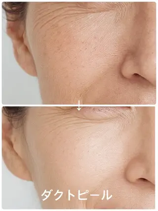 【LEPUS】 nishimoriのエステ・リラクイメージ