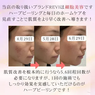 小林 千紘のエステ・リラクイメージ