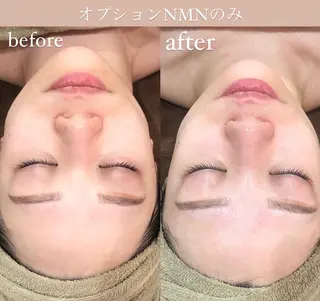 NiU.BEAUTY🥥池袋店所属・ハーブピーリング専門 NiU.BEAUTYのエステ・リラクイメージ
