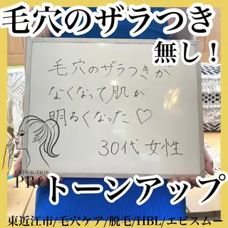 epismoo 脱毛/HBL/毛穴の眉毛・アイブロウイメージ