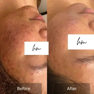 hm NATURESKINのエステ・リラクイメージ