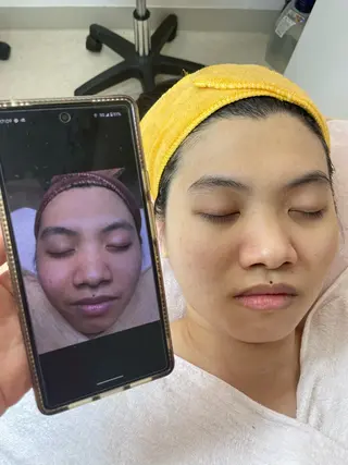 ニキビ、痩身、脱毛、 サクラチャンスパのエステ・リラクイメージ