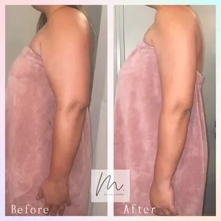 SHARES MADOKAのエステ・リラクイメージ