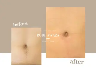 全身脱毛&ブラジリアンワックスサロン rudi 【ルディ】阿波座店所属・【脱毛/眉毛専門店】 rudi　阿波座店の眉毛・アイブロウイメージ