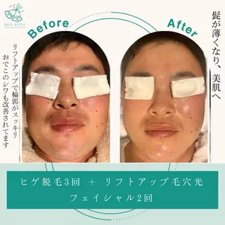 メンズ キッズ メンズ&レディース　Bell style所属・【脱毛・美肌専門】 bellstyleのエステ・リラクイメージ