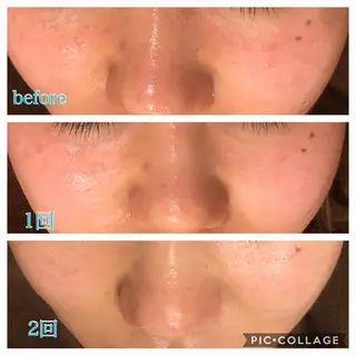 セミロング カラー パーマ ヘアアレンジ キッズ ネイル マツエク・マツパ Ensor Clair所属・EnsorClair 代表 野口真央のエステ・リラクイメージ