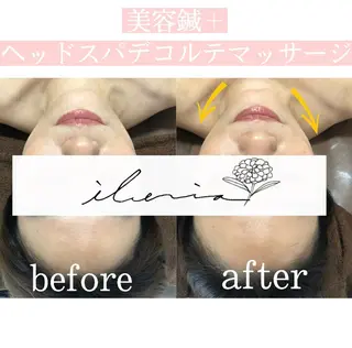 心斎橋痩身ダイエット 韓国.美容鍼.小顔のエステ・リラクイメージ