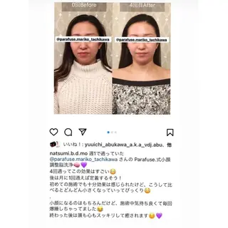 PARAFUSE.立川店 夢みる寝落ち空間所属・脳洗浄®︎立川/ 小顔ドライヘッドスパのエステ・リラクイメージ