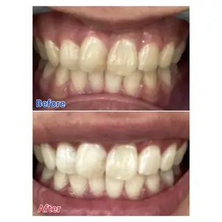 MBEAUTYSALON 千葉店・京成大久保所属・Melty 輝のその他イメージ