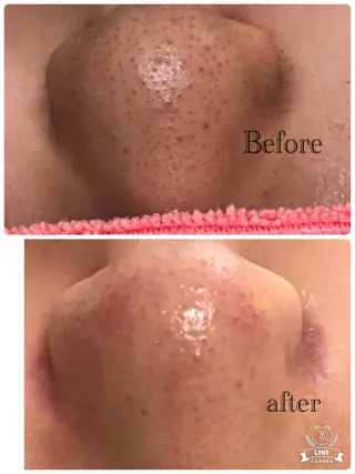 サロンドプララン所属・サロンド プラランのエステ・リラクイメージ