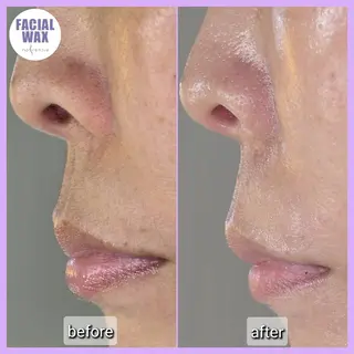 facial salon Lily所属・salon Lilyのエステ・リラクイメージ