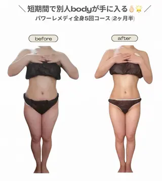 biloop所属・BILOOP ﾋﾞﾙｰﾌﾟのエステ・リラクイメージ