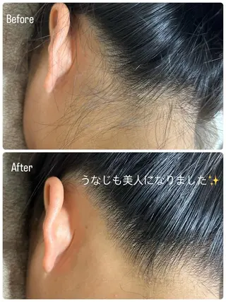Beauty salon Wish所属・脱毛🌈肌質改善🌈 Wishのエステ・リラクイメージ