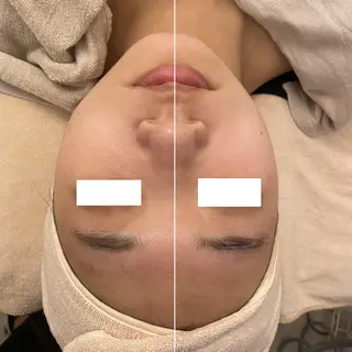 ✨美肌水光✨ アトリエリュバンのエステ・リラクイメージ