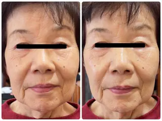 Eyelash Salon 4Uのマツエク・マツパデザイン