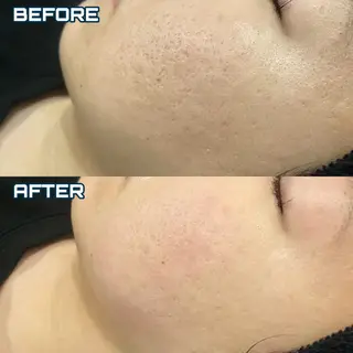 セミロング カラー パーマ ヘアアレンジ メンズ キッズ ネイル マツエク・マツパ アイブロウ NANI OAFU所属・NANIOAFU [なんば店］のその他イメージ