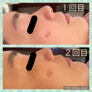 Serenity salonのエステ・リラクイメージ