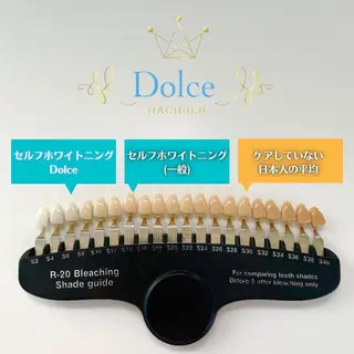 セルフホワイトニング Dolce八王子店のその他イメージ