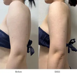 冷却専門店 SLARIのエステ・リラクイメージ