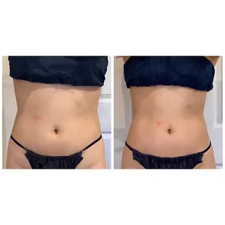 毛穴洗浄・痩身・脱毛 /アルカンジュのエステ・リラクイメージ