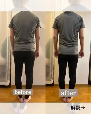 メンズ ANZ美容整体所属・美姿勢|痩身|目黒 ANZ-美容整体-のエステ・リラクイメージ