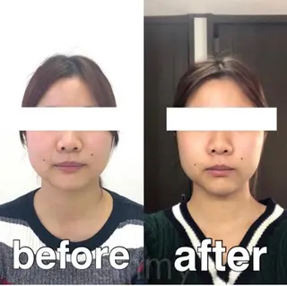 小顔と ヘッドスパのお店のエステ・リラクイメージ