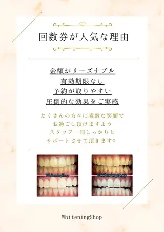 ホワイトニングショップ静岡葵区店所属・ホワイトニング ショップ静岡葵区店のその他イメージ