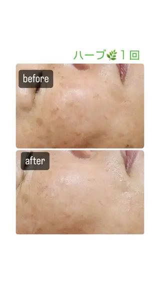 志免町 フェイスシャルエステのエステ・リラクイメージ