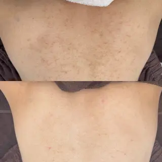 Nicore所属・肌質改善🌿まつ毛 chapiのエステ・リラクイメージ