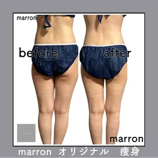 marron所属・痩身ハイパーナイフ ララピールリアボーテのエステ・リラクイメージ
