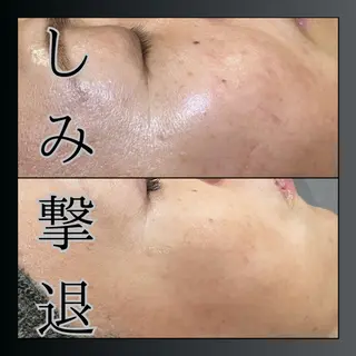 LiZA エステティックサロンのエステ・リラクイメージ