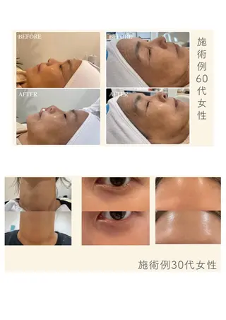 Petila所属・Petila千葉🫧 Ａｙａｋａのエステ・リラクイメージ