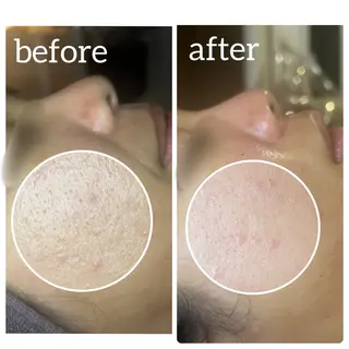 BEAUTY SALON R's所属・BEAUTY SALON R'sのエステ・リラクイメージ