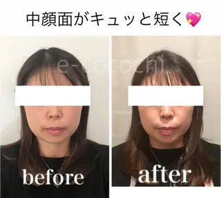 小顔と ヘッドスパのお店のエステ・リラクイメージ