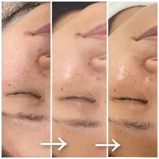 beauty salon by BMbm所属・名倉 彩乃のエステ・リラクイメージ