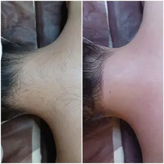 Lutella所属・ワックス脱毛専門店 Lutellaのエステ・リラクイメージ