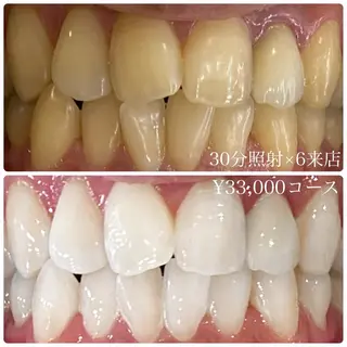 PLATINUM Beauty 横浜店所属・ホワイトニングルーム 横浜店のその他イメージ