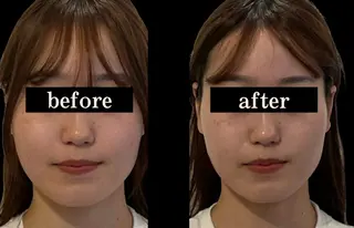 小顔/たるみ/黒ずみ除去専門サロン/SONA 大和西大寺店所属・【小顔専門看護師 サロンSONA】のエステ・リラクイメージ