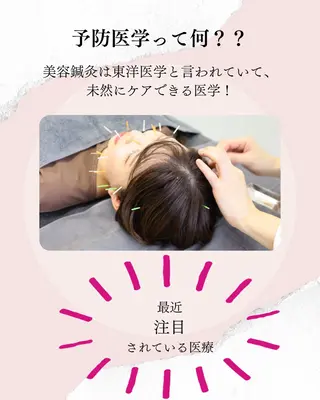 ニキビ特化美容鍼 ×ハーブピーリングのエステ・リラクイメージ