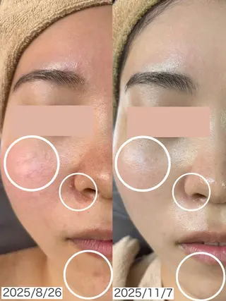 WHITE AQUA 北千住店のエステ・リラクイメージ