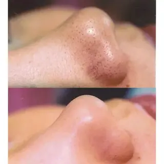 BestBelleꕤ 大阪福島/肌質改善のエステ・リラクイメージ