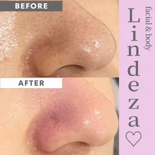 リンデザ 山口のエステ・リラクイメージ