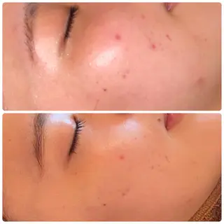 FLEUR大阪・整体 ・ハイフ・痩身・小顔のエステ・リラクイメージ