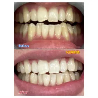 M渋谷店所属・Ｍ渋谷 ホワイトニングのエステ・リラクイメージ