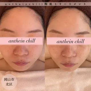 アンテインチル 山本のエステ・リラクイメージ