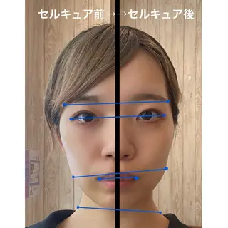 小顔専門☠️ 筋膜/脂肪/毛穴洗浄のエステ・リラクイメージ